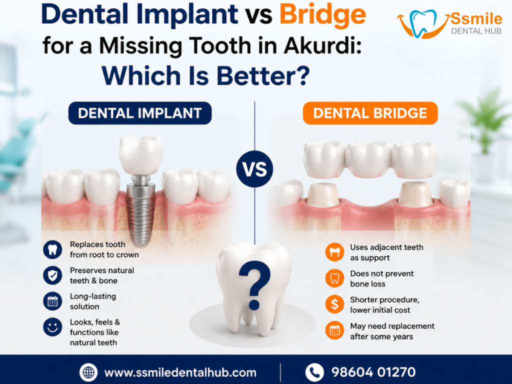 dental implant vs bridge missing tooth Baner