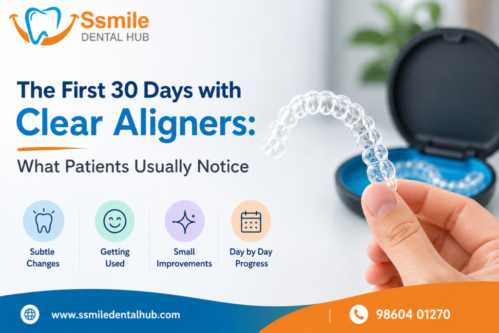 first 30 days with clear aligners